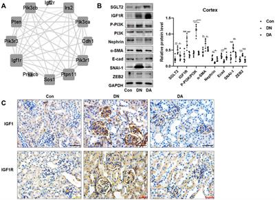 SGLT2 inhibitors suppress epithelial–mesenchymal transition in podocytes under diabetic conditions via downregulating the IGF1R/PI3K pathway